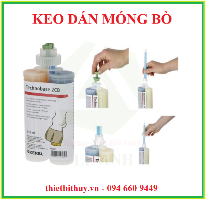 KEO DÁN MÓNG BÒ - CUỘN BĂNG VẾT THƯƠNG - THIETBITHUY.VN